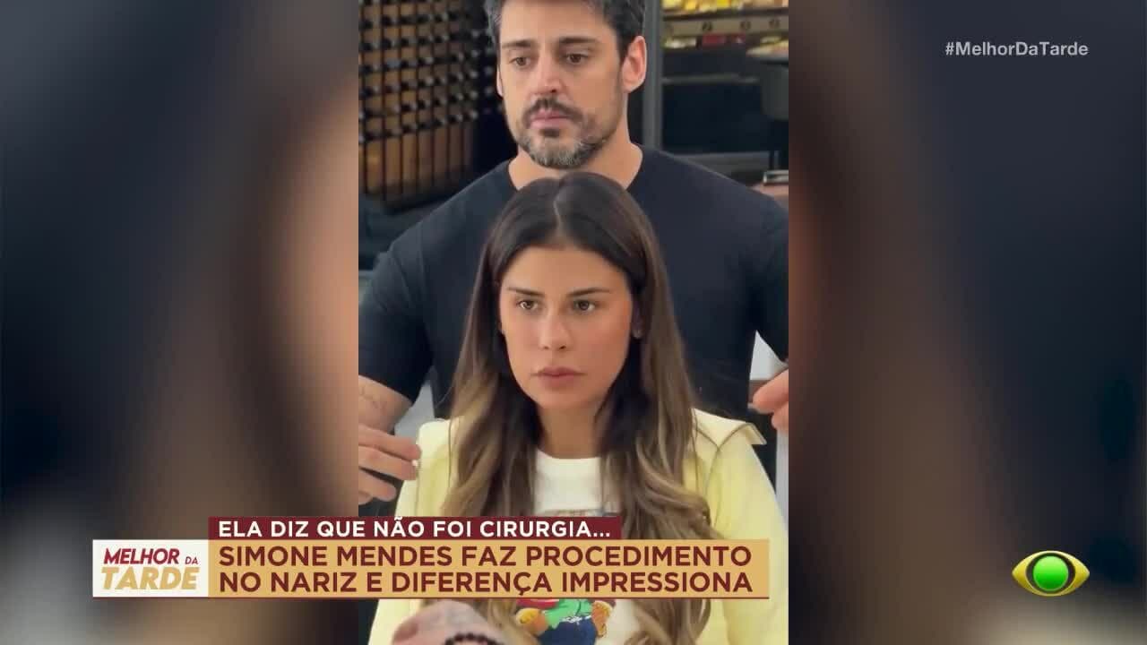 Simone Mendes faz rinomodelação: entenda como funciona o procedimento
