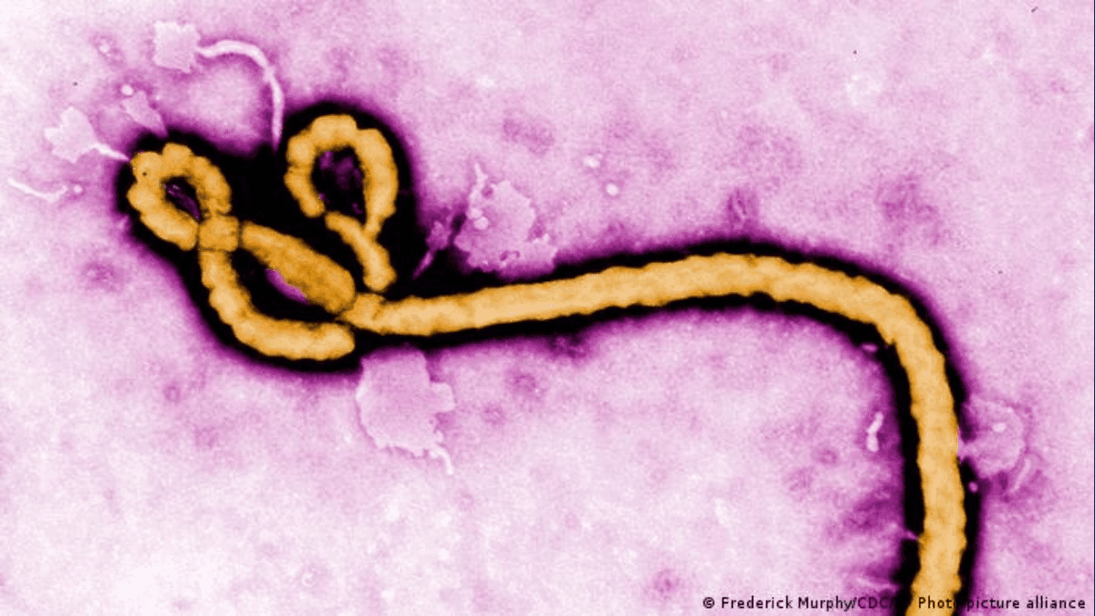 Secretaria descarta caso suspeito de ebola em São Paulo