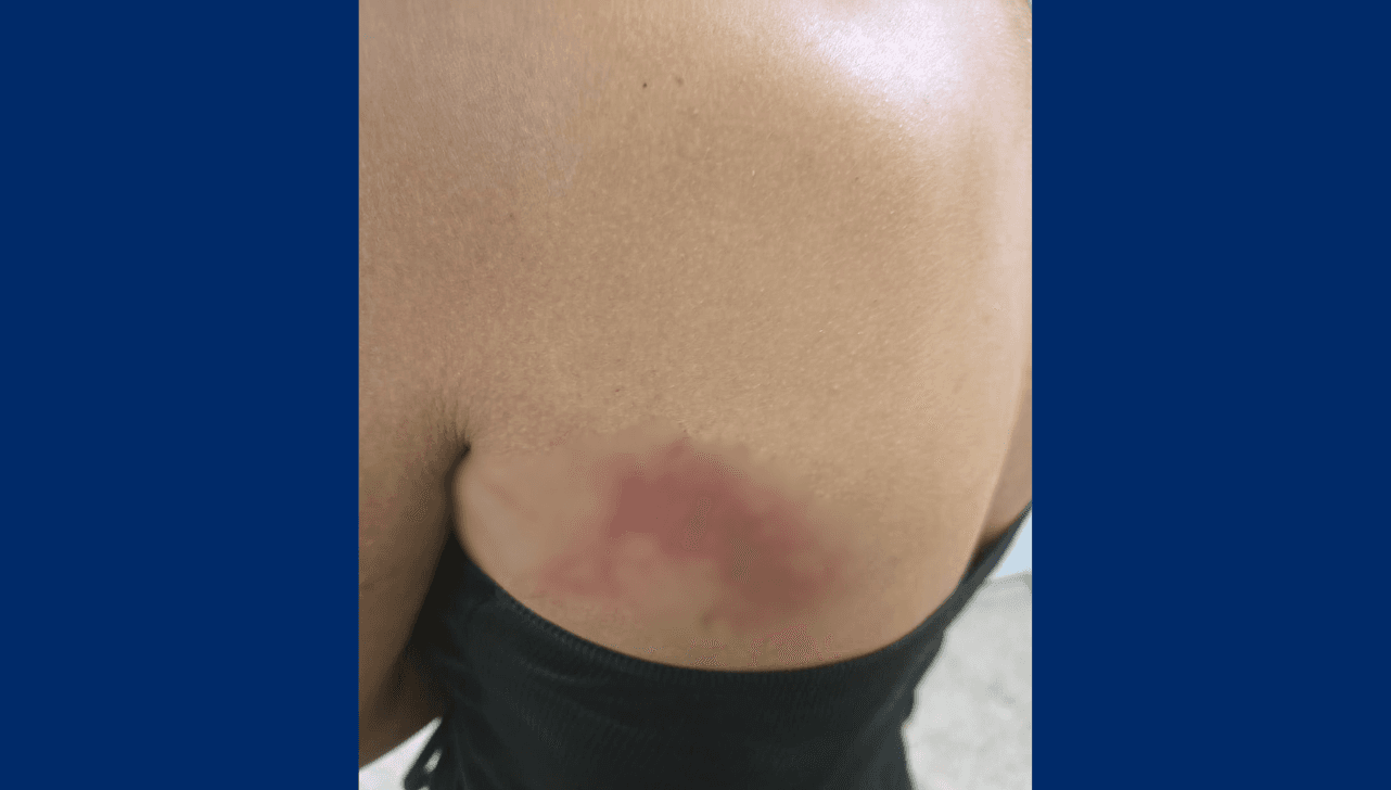 Mulher foge de agressão feita por companheiro e pede ajuda na UPA