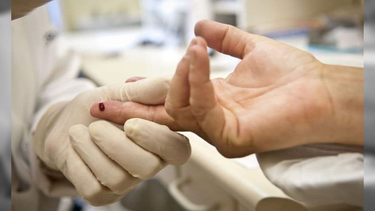 Paulínia realiza testes de sífilis, HIV e Hepatites B e C nesta terça (18)