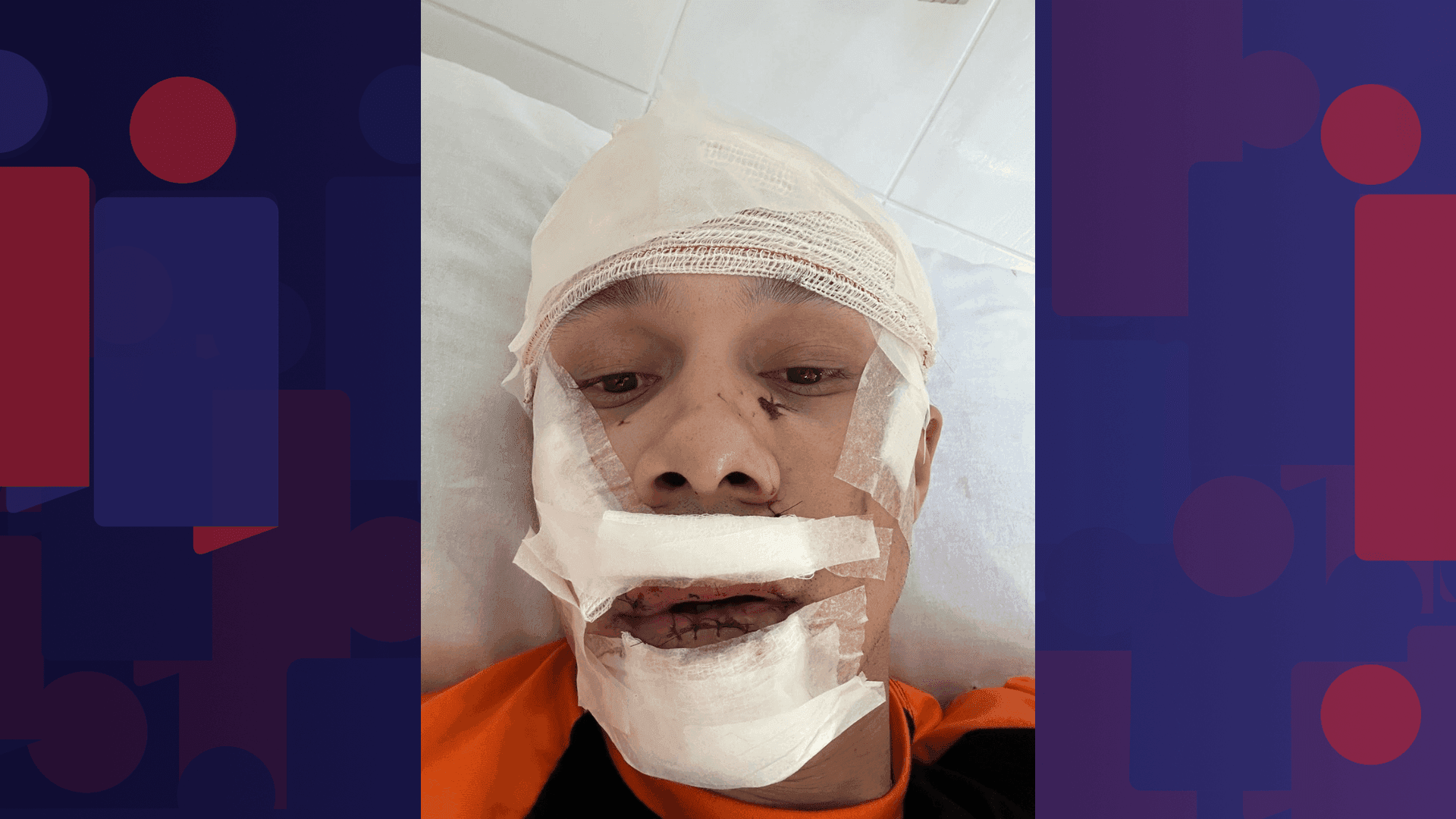 Polícia tenta identificar agressor de personal carioca atacado com taça em bar de São Paulo