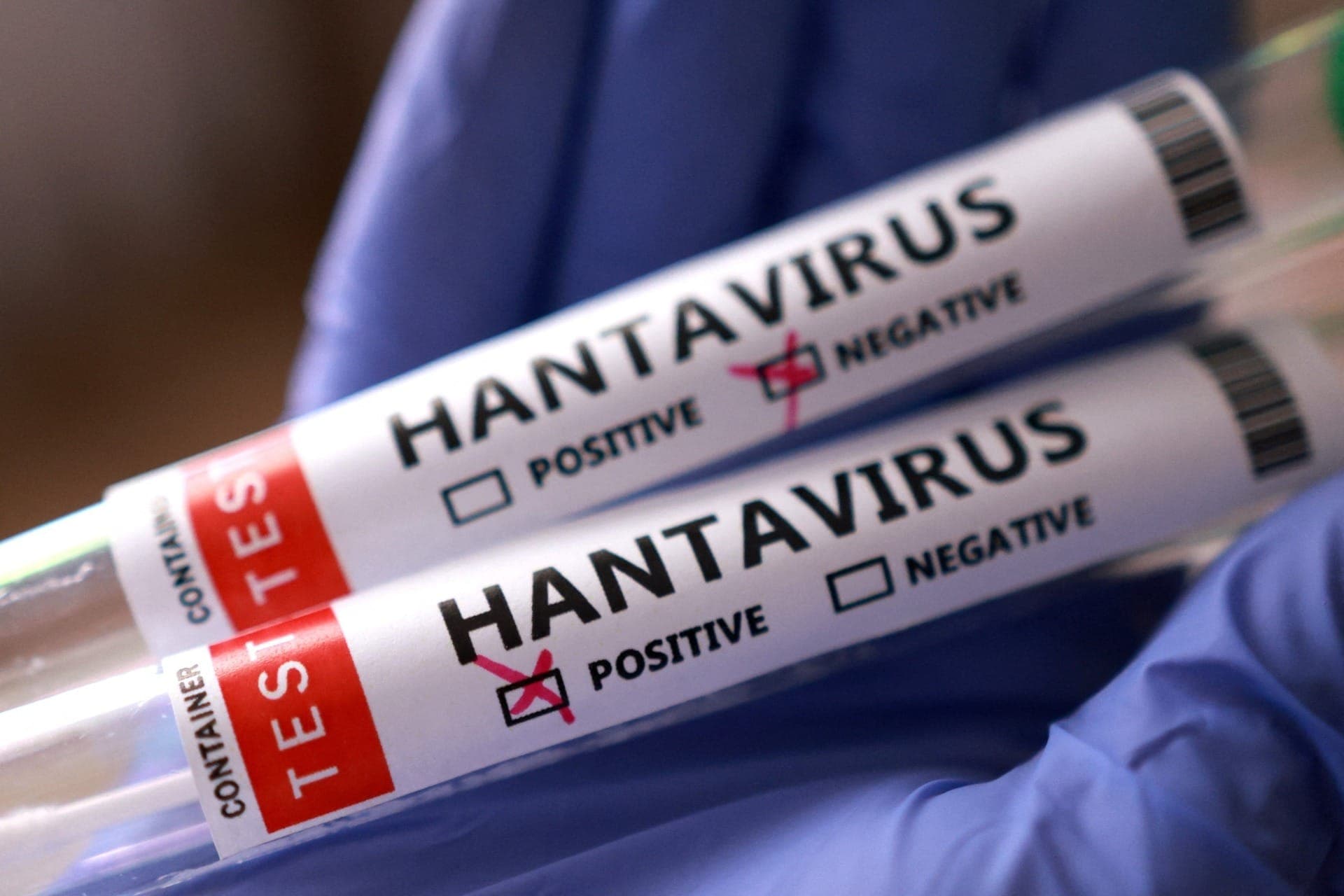 Hantavírus: cidadãos dos EUA e França que estavam em navio testam positivo