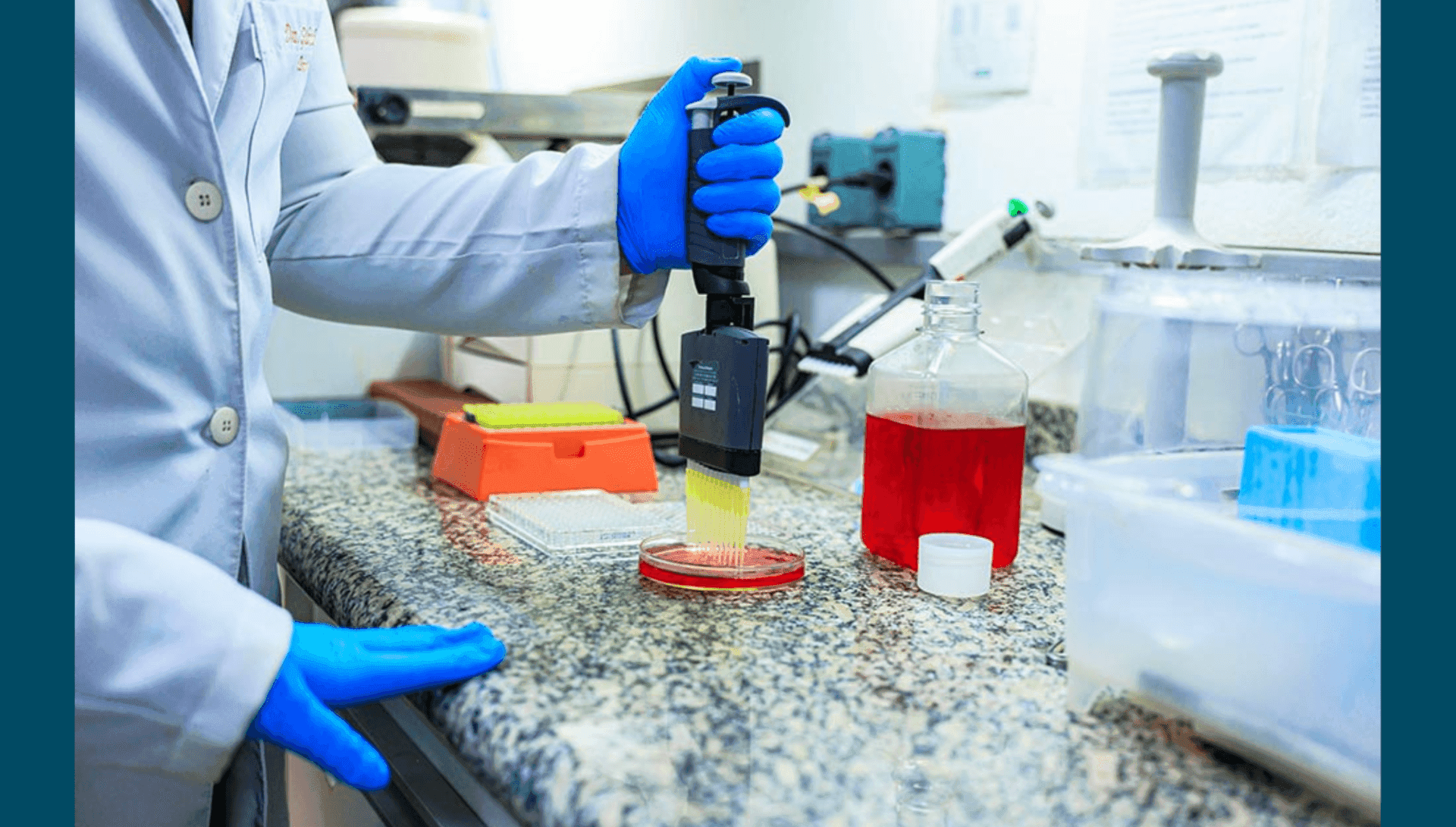 Unicamp desenvolve técnica que pode ampliar acesso ao transplante capilar