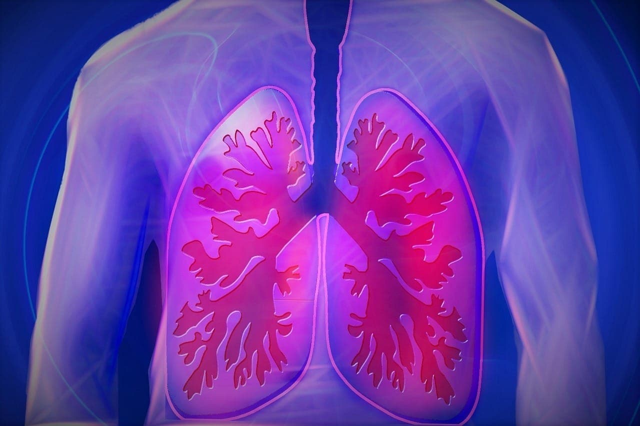 Como funciona a radioterapia no câncer de pulmão
